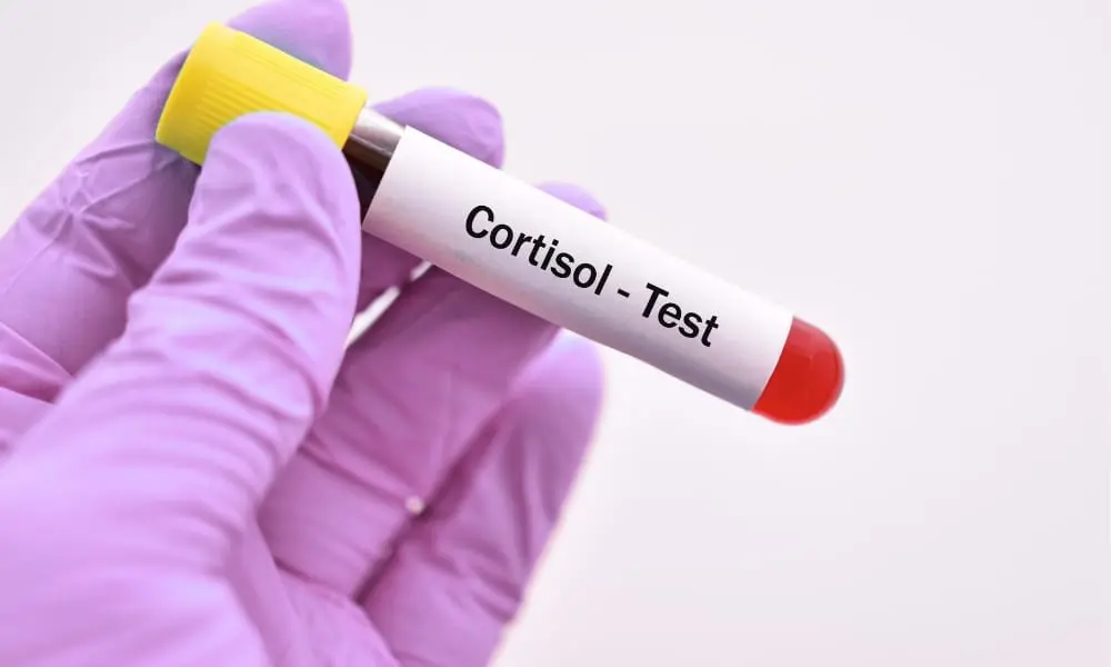 Da li je kortizol uvek loš kortizol test